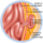 cirugias-Hernias-Gigantes-dr-Alban